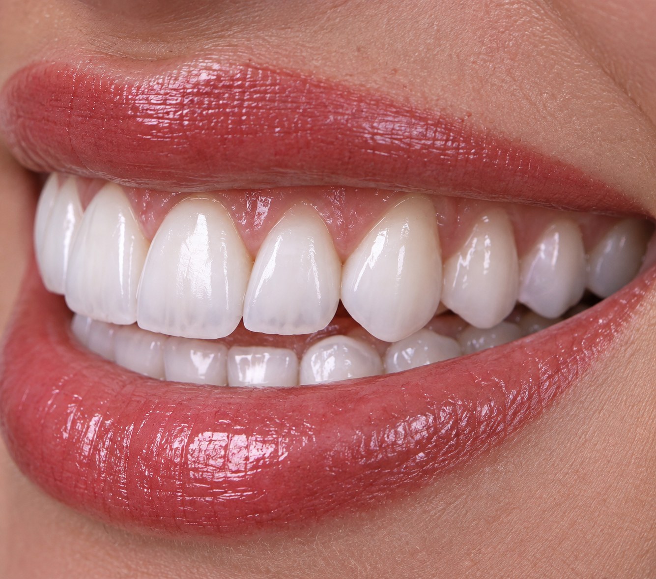 Three quarter view of a natural porcelain smile showing tooth proportions and surface texture