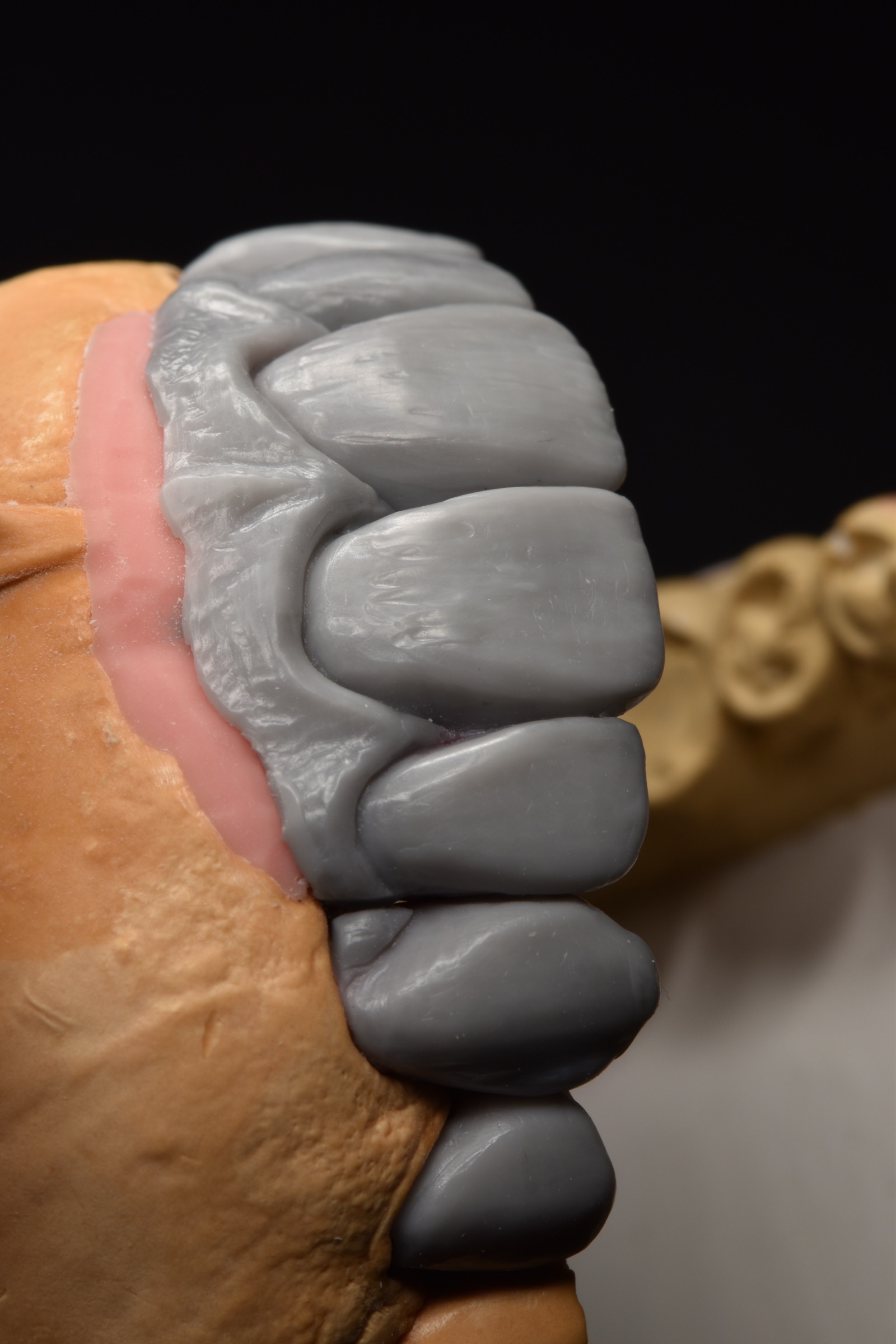 First oblique view of the diagnostic wax-up
