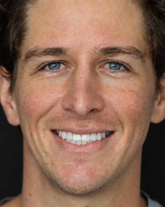 After treatment, full-face frontal smile